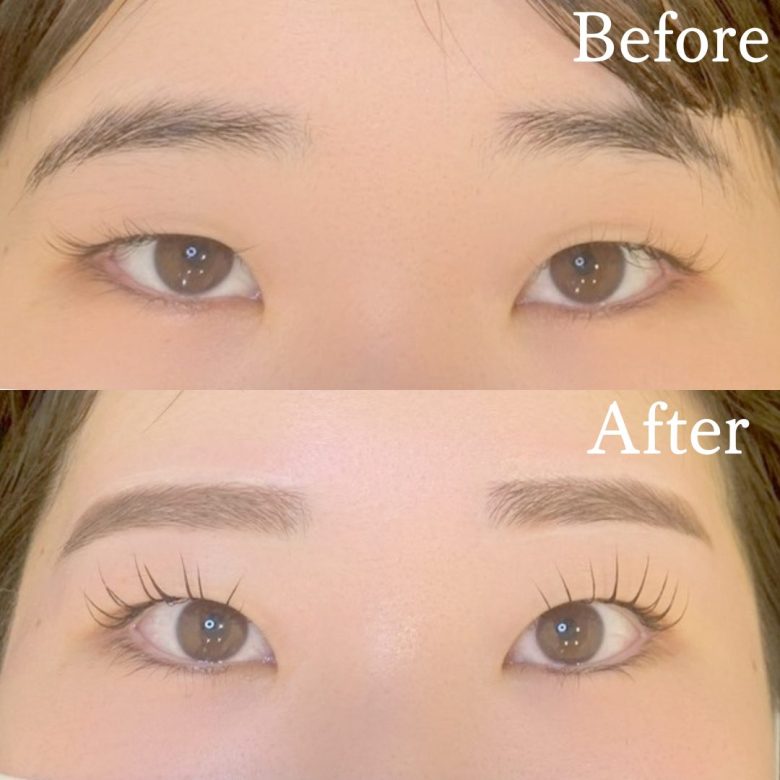 記事のサムネイル